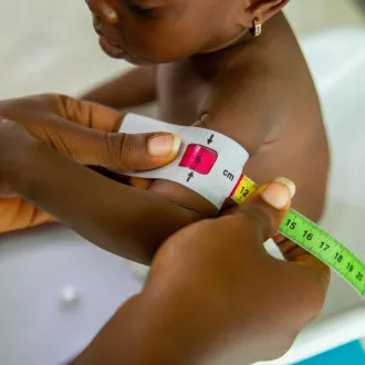 Strategies prevent malnutrition elderly people seniors - nutrition geriatrics